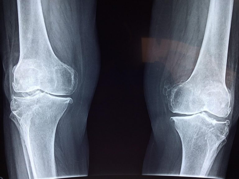 Brooklyn Injury Lawyers, P.C.